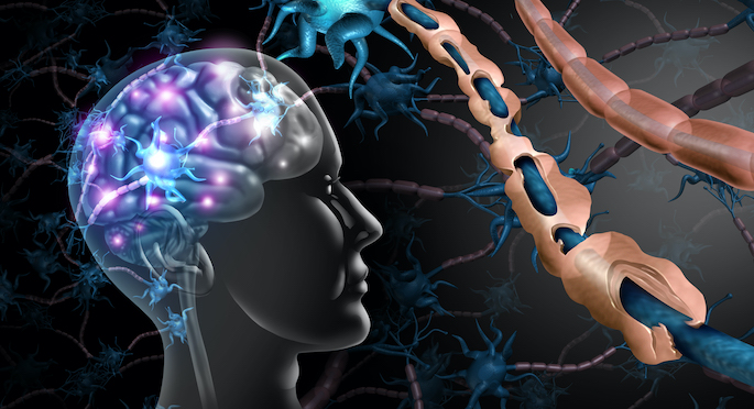 The outline of a head, with the axons and neurons highlighted in the brain