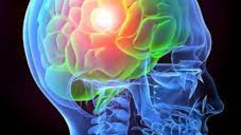 Picture of Xray of TBI in human head.